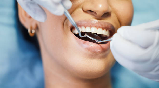 Best Urgent Tooth Repair  in Lambertville, MI